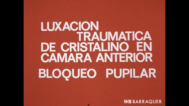 016 Luxación traumática del cristalino en CA, bloqueo pupilar-Joaquín Barraquer-1968 Barcelona