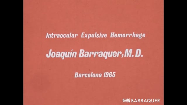 028 Intraocular expulsive hemorrhage-Prof. Joaquín Barraquer-1965 Barcelona