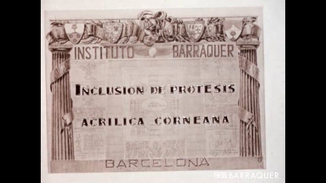 032 Inclusión de prótesis acrílica corneana-Prof. Joaquín Barraquer-1957- Barcelona