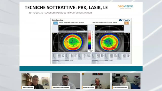 NAO – Chirurgia refrattiva: quando e a chi