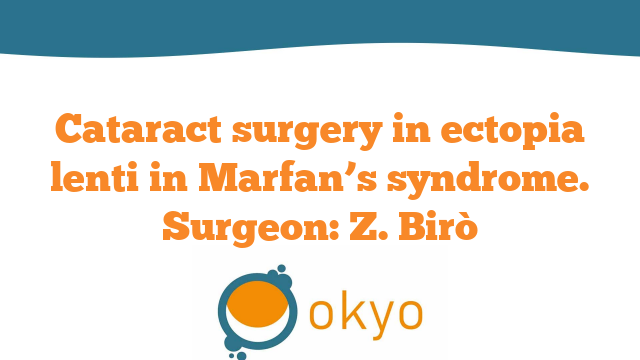 VCR 2018 – Cataract surgery in Ectopia Lenti in Marfan’s syndrome – Z. Birò