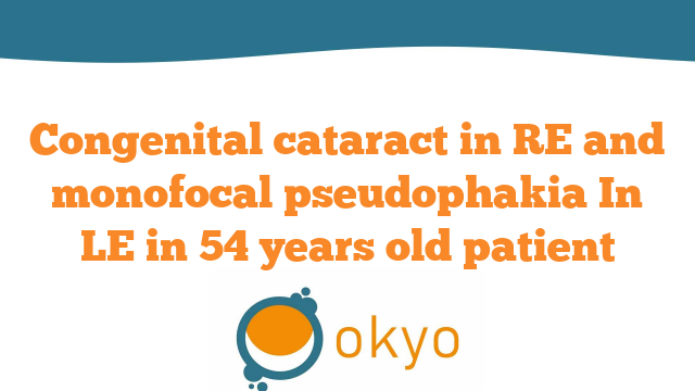 Congenital Cataract in RE and Monofocal Pseudophakia In LE in 54 years old patient – L. Buratto