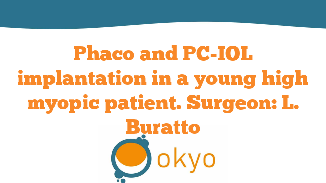 Phaco and PC-IOL implantation in a young high myopic patient – L. Buratto