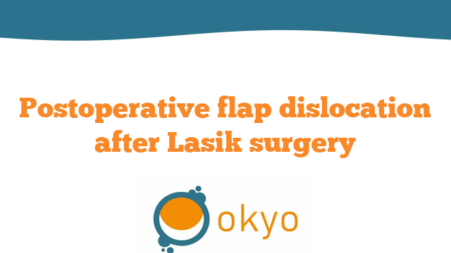 Postoperative Flap Dislocation after Lasik Surgery – L. Buratto