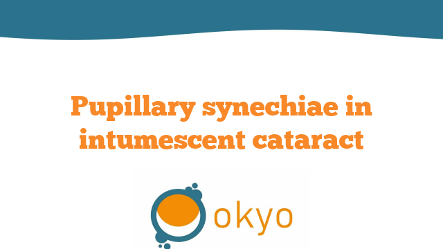 VCR 2019 – Pupillary synechiae in intumescent cataract – Z. Birò